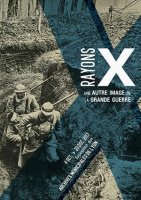 Rayons X, une autre image de la Grande Guerre